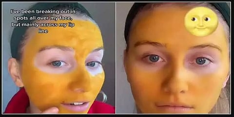 “கழுவிட்டு வந்தேன்னா நிலா மாதிரி முகம் ஜொலிக்கும்” - டிக்டாக் பிரபலத்திற்கு நேர்ந்த சோகம்