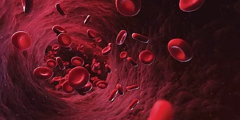 உடலில் இரும்புச்சத்து குறைவாக இருப்பதற்கான அறிகுறிகள்!