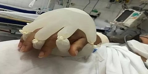 பிரேசில்: உயிருக்கு போராடி வரும் கொரோனா நோயாளிகளுக்கு உதவும் "அன்பின் கரங்கள்"