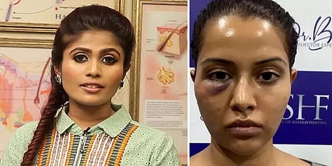 முகம் வீங்கிய விவகாரம் - ரைசா பணம் கேட்டு மிரட்டுவதாக மருத்துவர் பைரவி குற்றச்சாட்டு