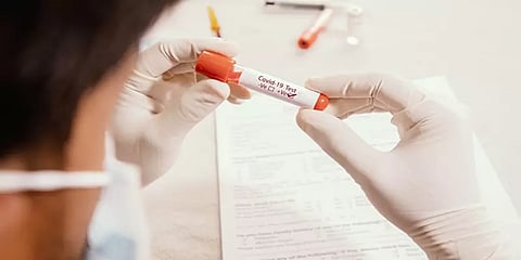 கர்நாடகா: ஒரு கிராமத்தில் 50 சதவிதம் பேருக்கு கொரோனா!