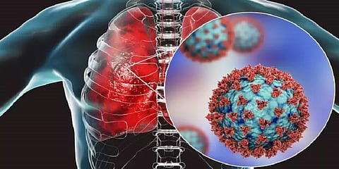 "கொரோனா 2-ஆம் அலையில் நுரையீரல் பாதிப்புகள் முன்கூட்டியே தொடக்கம்"- மருத்துவர்கள்
