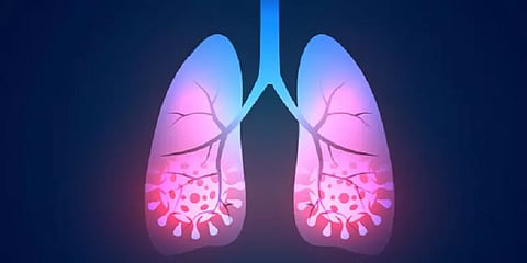 கொரோனாவின் பக்கவிளைவான முகோர்மைகோஸிஸை கண்டு அச்சம் வேண்டாம் - மருத்துவர் அறிவுரை