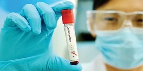 தமிழகத்தில் கொரோனா தொற்று பரவல் அதிகம்: மத்திய அரசு