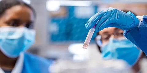 தமிழகத்தில் ஒரே நாளில் 33,181 பேருக்கு கொரோனா தொற்று உறுதி; 311 பேர் உயிரிழப்பு