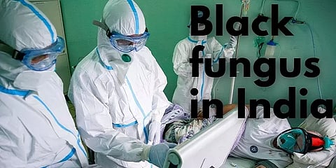 கருப்பு பூஞ்சை தொற்றை, பெருந்தொற்றாக அறிவித்த ராஜஸ்தான் அரசு