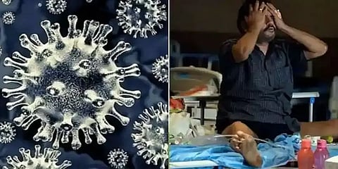 கருப்பு பூஞ்சை தொற்றை, பெருந்தொற்றாக மாநில அரசுகள் அறிவிக்க வேண்டும்: மத்திய அரசு கடிதம்