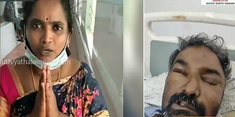 மேட்டூர்: கருப்பு பூஞ்சை நோயால் பாதித்த கணவரை காப்பாற்ற வீடியோ வெளியிட்ட மனைவி