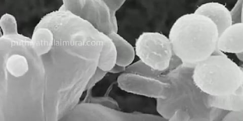 பீகார்: கருப்பு பூஞ்சையை தொடர்ந்து ஆபத்தான வெள்ளை பூஞ்சைகளின் பாதிப்பு