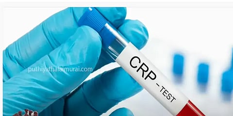 வீட்டுத்தனிமையில் இருப்போருக்கு 'சி ரியாக்ட்டிவ் புரோட்டீன்' சோதனை அவசியம்... ஏன்?