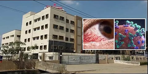 மதுரை: கருப்பு பூஞ்சை அறிகுறியுடன் வருபவர்களுக்கு தனி வார்டு