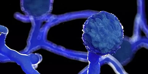 இந்தியாவில் கருப்பு பூஞ்சை நோய் தொற்றின் மருந்துகளுக்கான தட்டுப்பாடு எப்போது சரியாகும்?