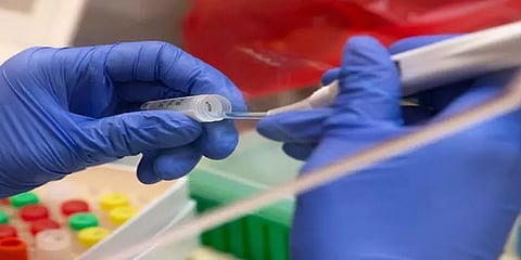 எத்தனை நாட்களில் கிடைக்கும் ஆர்டிபிசிஆர் முடிவுகள்?