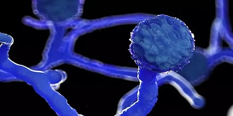 தமிழகத்தில் 400 பேருக்கு கருப்பு பூஞ்சை பாதிப்பு