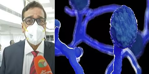 கருப்பு பூஞ்சைக்கு அச்சம் வேண்டாம்... எச்சரிக்கை அவசியம் - மருத்துவர் காமேஸ்வரன்