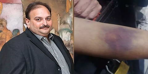 மெஹூல் சோக்சியை அழைத்து வருவதற்கு விமானத்தில் ஆவணங்களை அனுப்பிய இந்தியா