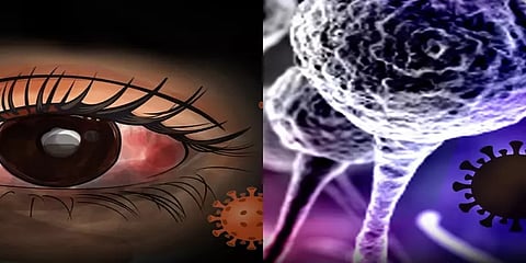 தமிழ்நாட்டில் கருப்பு பூஞ்சை நோயால் இதுவரை 847 பேர் பாதிப்பு