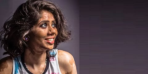 "அழகு தோலில் இருக்காது, பிரியத்தில்தான் இருக்கும்" - மாடல் ரம்யா கிரிஸ்டினா ’பளிச்’ பேட்டி