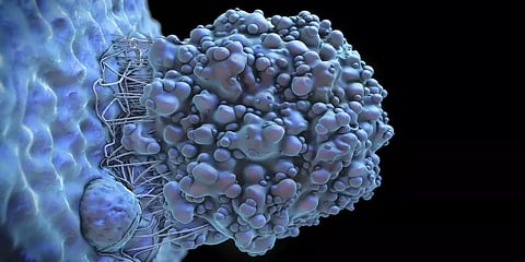 மதுப்பழக்கத்தால் கடந்த ஆண்டு உலகளவில் 7.4 லட்சம் பேருக்கு புற்றுநோய்