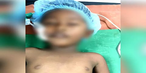 சிறுவனின் தொண்டையில் சிக்கிய நாணயம்: வெற்றிகரமாக அகற்றிய அரசு மருத்துவர்கள்