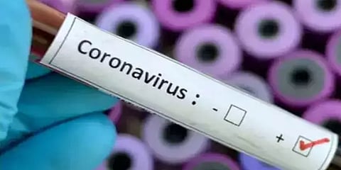 அரியலூர்: அரசு மேல்நிலைப்பள்ளியில் பயிலும் மேலும் 3 மாணவ, மாணவிகளுக்கு கொரோனா தொற்று உறுதி