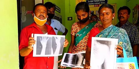 “நிதி பற்றாக்குறை” - எக்ஸ்ரே முடிவுகளை காகிதத்தில் எழுதி வழங்கும் அரசு மருத்துவமனை