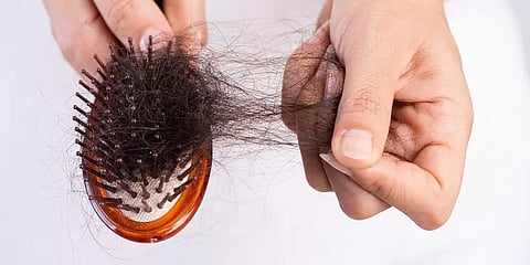 “முடி உதிர்தல் பிரச்னைக்கு மன அழுத்தமும் ஒரு முக்கிய காரணம்” - சரும நிபுணர் விளக்கம்