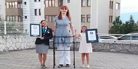 கின்னஸில் இடம்பிடித்த உலகின் உயரமான பெண்ணுக்கு பின்னால் இப்படியொரு கதையா?