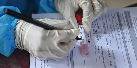 கர்நாடகாவில் 7 பேருக்கு மரபணு மாற்றமடைந்த AY 4.2 வைரஸ் டெல்டா வகை கொரோனா பாதிப்பு உறுதி