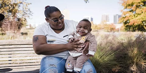 ’கின்னஸ் சாதனை’ - உலகிலேயே மிகவும் குறைமாதப் பிரசவத்தில் பிறந்து உயிர் பிழைத்த குழந்தை