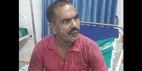 நெல்லை: தின்பண்டத்தை திருடியதாக 10 வயது சிறுமியை தீவைத்து எரித்த வளர்ப்பு தந்தை