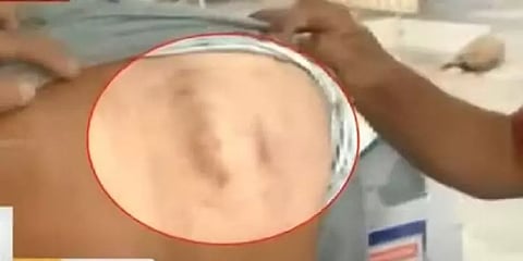 கோவை: உடை இறுக்கமாக அணிந்த மாணவனை அடித்த ஆசிரியர்மீது பெற்றோர் புகார்