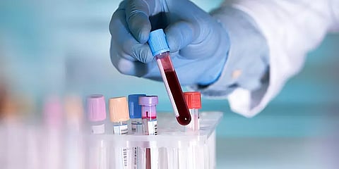 சென்னையில் நிறுவப்பட்ட மரபணு பகுப்பாய்வு கூடத்திற்கு மத்திய அரசு அனுமதி