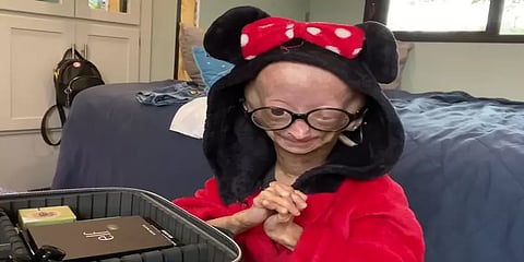 'அமைதியாகவே வந்தாள்;அமைதியாக சென்றுவிட்டாள்'-யூடியூப் நட்சத்திரமான 15வயது சிறுமி காலமானார்