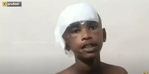 நாமக்கல்: அறுவை சிகிச்சைக்கு பின் உயிர் பிழைத்த சிறுவனிடம் போனில் நலம் விசாரித்த முதல்வர்