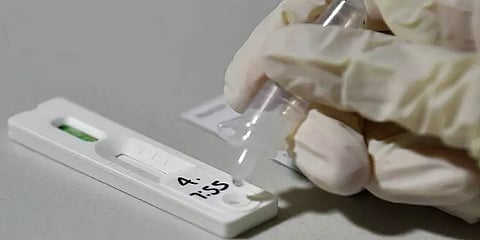 கோவை: சுய பரிசோதனை டெஸ்ட் கிட் பயன்பாட்டால் கொரோனா அதிகரிக்கும் அபாயம்