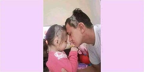 மகளுக்கு மூளையில் அறுவை சிகிச்சை: தந்தை செய்த செயலால் நெகிழும் நெட்டிசன்கள்