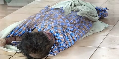 விளையாட்டாக வைக்கோலில் குழந்தைகள் பற்ற வைத்த நெருப்பு - பெண் குழந்தைக்கு நேர்ந்த சோகம்