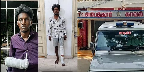 பொதுமக்களை அரிவாளால் தாக்கிய இருவர்: கை, கால் முறிவடைந்த நிலையில் கைது