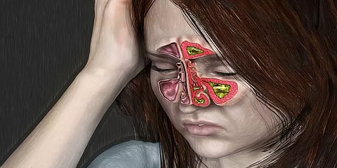 'இந்த மூக்கும் தும்மலும் இருக்கே!'-சைனஸ் பிரச்னைக்கான காரணங்களும் வகைகளும் #DoctorExplains