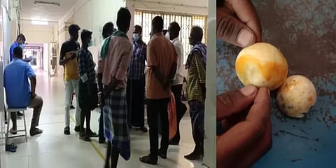 மதிய உணவில் அழுகிய முட்டை? - மயங்கி விழுந்த பள்ளி மாணவர்கள் 25 பேருக்கு சிகிச்சை