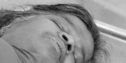 சிகிச்சை எடுக்காமல் அலட்சியம்.. நாய்க்கடிக்கு ஆளான பெண்ணுக்கு நேர்ந்த சோகம்!