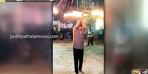 புதுச்சேரி: கோயில் திருவிழாவில் வெடி விபத்து - 3 சிறுவர்கள் உட்பட 4 பேர் காயம்