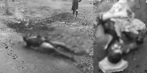 ’’காவல்துறை என்னை அவமானப்படுத்துகிறது’’ - தீக்குளித்த இளைஞர் அதிர்ச்சி வாக்குமூலம்