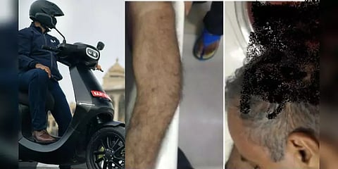 ரிவர்ஸ் மோடில் இயங்கிய ஓலா பைக்! விபத்து ஏற்பட்டு 65 வயது முதியவர் படுகாயம்!