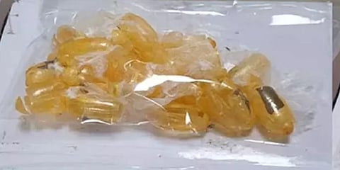 அசௌகரியமாக இருந்த உகாண்டா பெண்கள்.. சோதனையில் சிக்கிய அயன் பட பாணி உண்மைகள்!