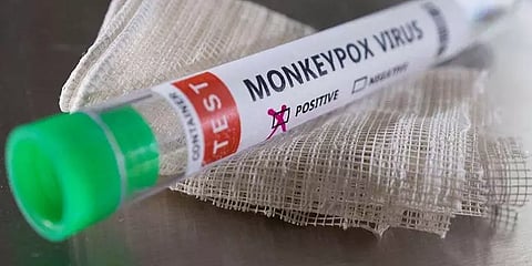 குரங்கு அம்மையை கண்டறிய புது பரிசோதனை முறை.. கண்டுபிடித்த இந்திய மருந்து நிறுவனம்!