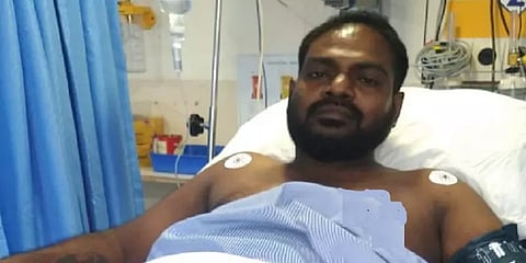 கார் மோதி ஓட்டுநர் கால் உடைந்த விபத்து - சொகுசு கார் ஓட்டிவந்த நபர்மீது வழக்குப்பதிவு