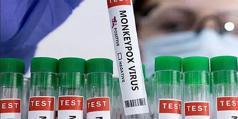 இந்தியாவுக்கும் பரவியதா குரங்கு அம்மை? 5 வயது குழந்தையின் மாதிரிகள் அனுப்பிவைப்பு