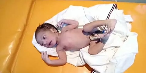 முட்புதரில் கண்டெடுக்கப்பட்ட பச்சிளம் ஆண் குழந்தை - போட்டுச்சென்றது யார்? போலீஸ் விசாரணை